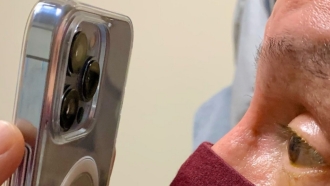 Un ophtalmologiste utilise l'appareil photo de l'iPhone 13 Pro pour évaluer les patients